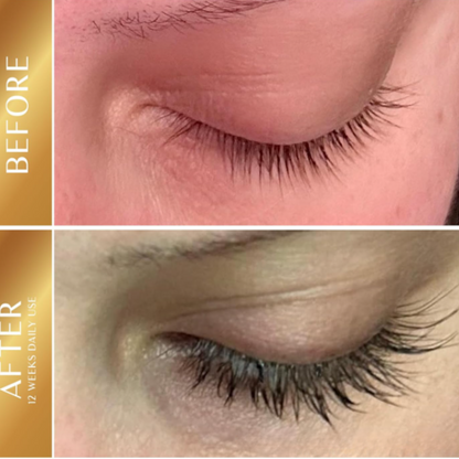 LUMIVIA™ — Eyelash Growth Serum -Save Up to 50% Today